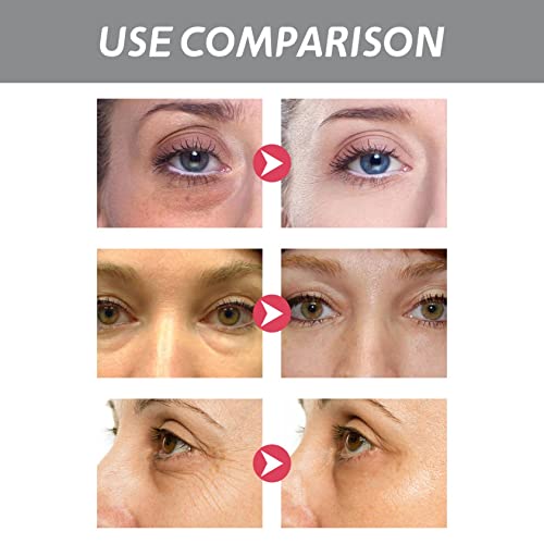 Retinol Göz Kremi Koyu Halkalar ve Şişlik, Anti-Aging Göz Kremi, Göz Kremi Altında Koyu Halkalar ve Şişlik 15 ml (2 ADET)